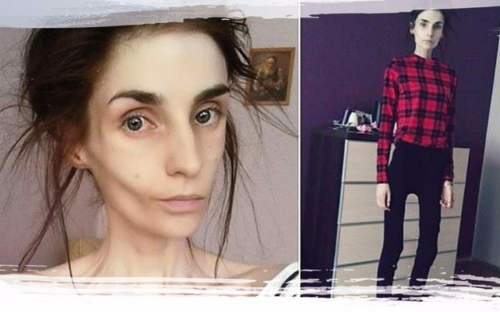 Zbiórka ❤ POMOZMY Patrycji i jej Tacie❤ - zdjęcie główne