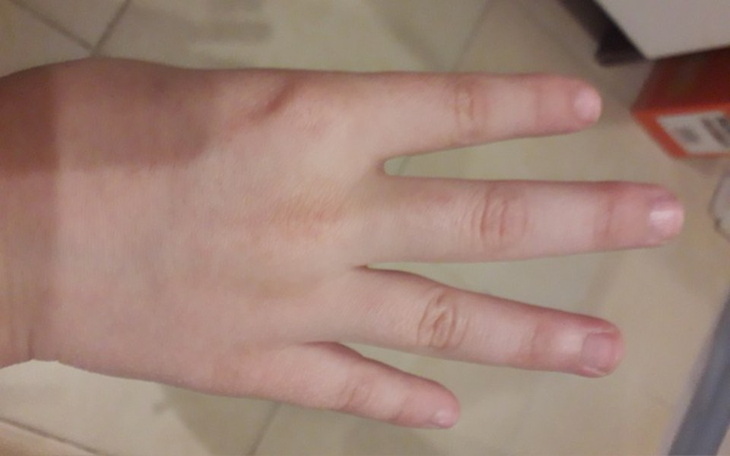 Zbiórka Na mały palec do ręki - zdjęcie główne