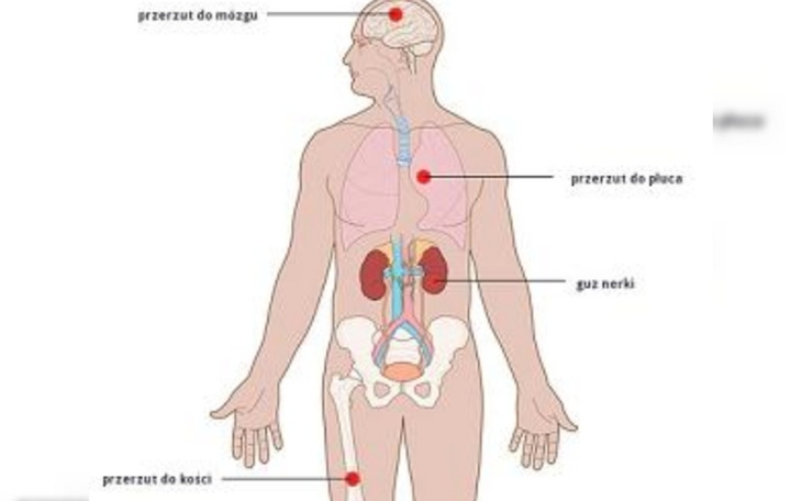 Zbiórka Zbiórka w chorobie - zdjęcie główne