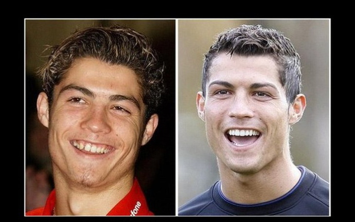 Zbiórka Równe zęby - zdjęcie główne