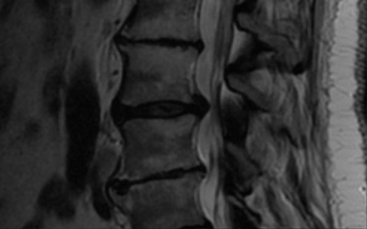 Zbiórka Kręgosłup który umiera - zdjęcie główne