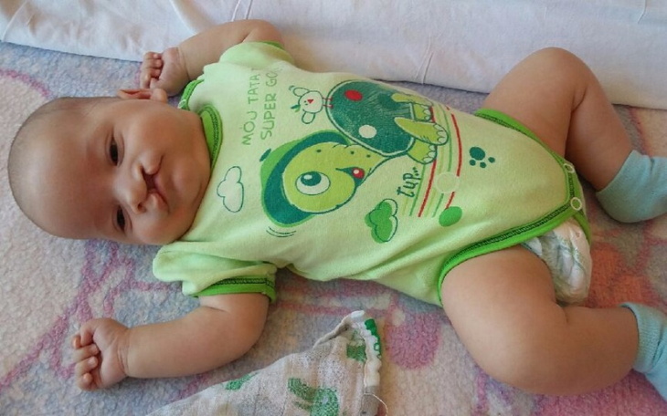 Zbiórka Na leczenie synka rafałka - zdjęcie główne