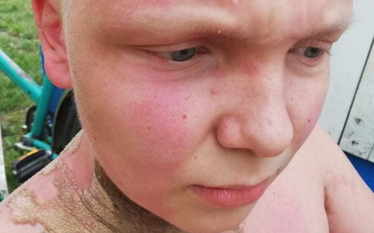 Zbiórka Pomóż Uratuj mnie przed wózkiem - zdjęcie główne