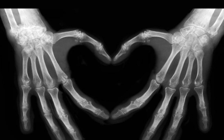 Zbiórka mały biznes - zdjęcie główne