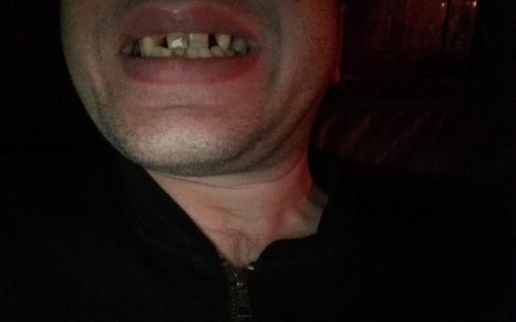 Zbiórka Na uzębienie - zdjęcie główne