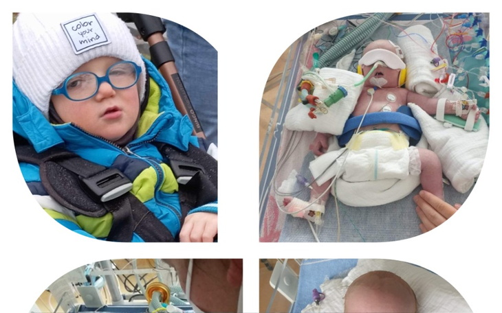 Dzieci w szpitalu, jedno z nich w niebieskiej kurtce i okularach.