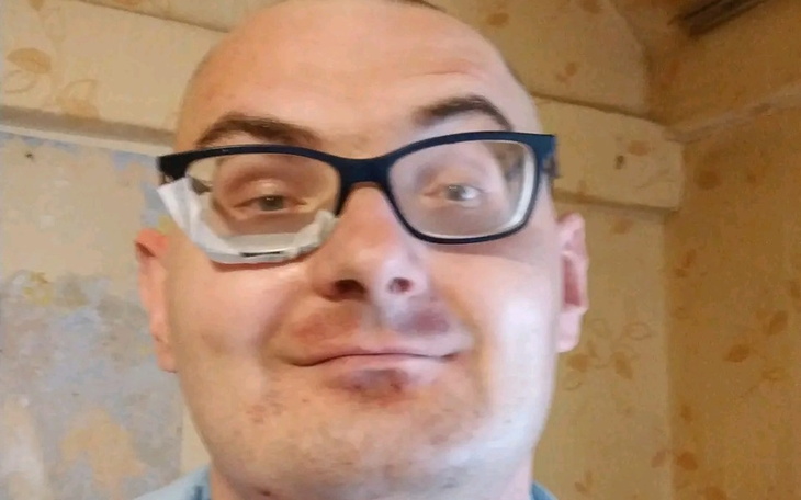 Zbiórka na telefon z lombardu 300 zł pom - zdjęcie główne