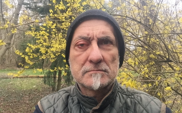 Mężczyzna z wyrazem twarzy, stojący wśród żółtych kwiatów.