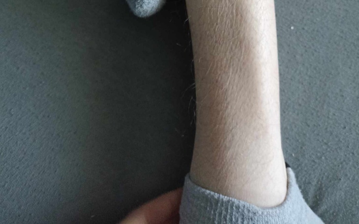 Zbiórka Rehabilitacja Taty. - zdjęcie główne