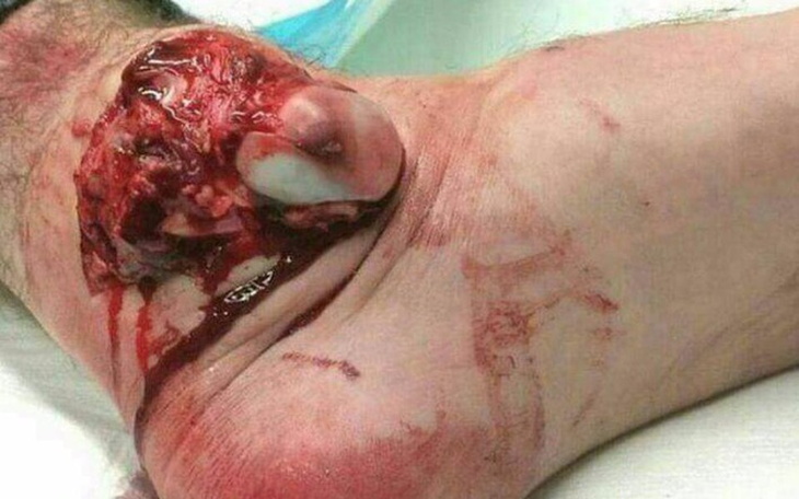 Zbiórka Jak zbiore to pomyślę po co - zdjęcie główne