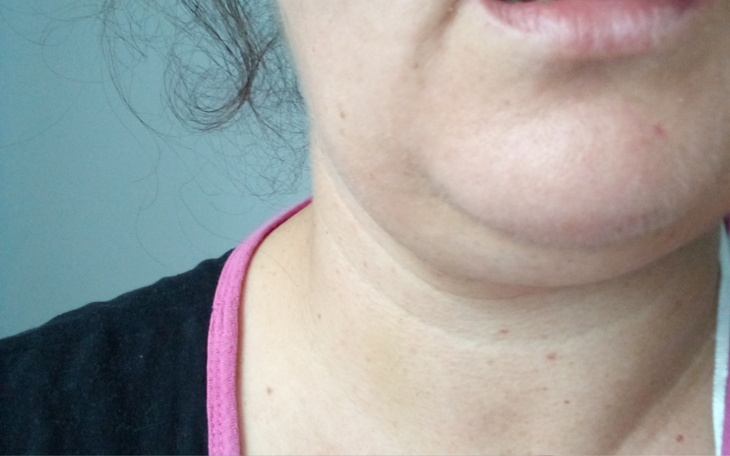 Zbiórka Nocleg i bilet - zdjęcie główne