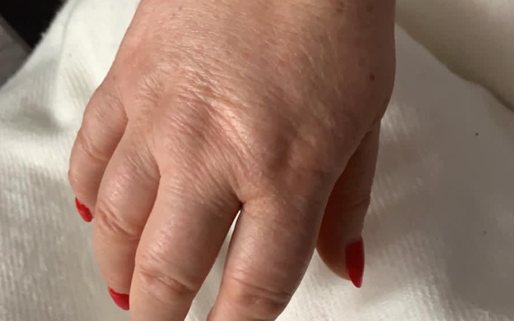 Zbiórka Powrót ręki do sprawności - zdjęcie główne