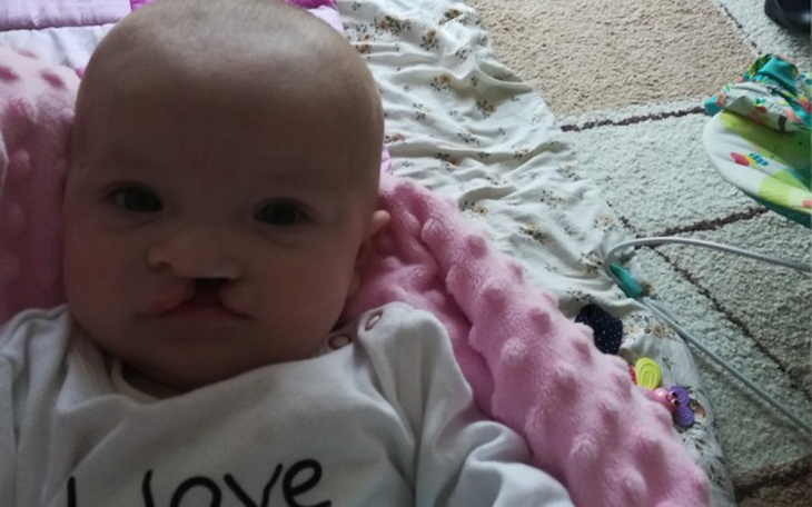 Zbiórka Leczenie- Rehabilitacja Julii - zdjęcie główne