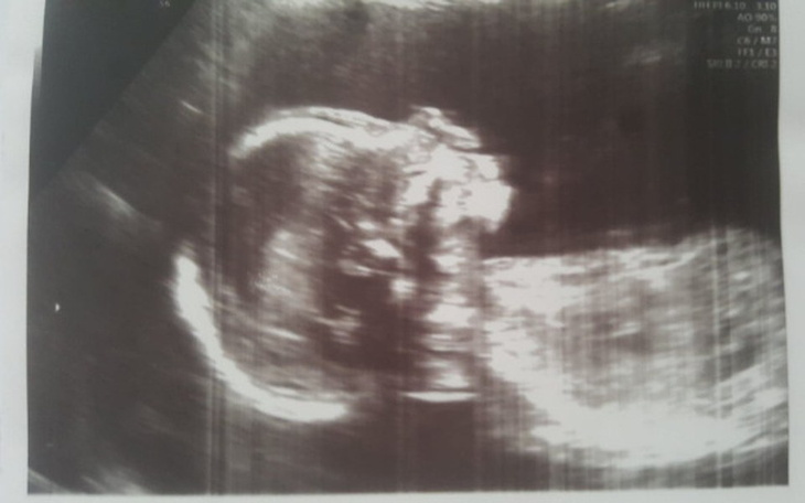 Zbiórka Prawo jazdy dla przyszłego Taty! - zdjęcie główne