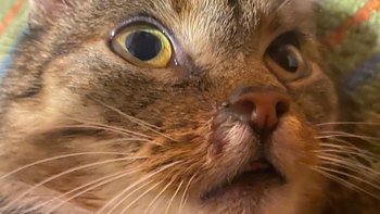 Zbiórka Endoskopia dla Mani - miniaturka zdjęcia