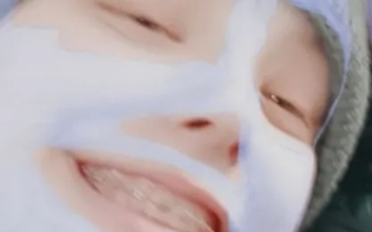 Zbiórka APARAT NA ZEBY dla Synka - zdjęcie główne