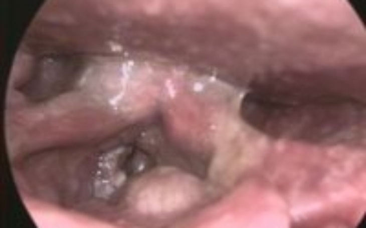 Zbiórka chory synek na raka - zdjęcie główne