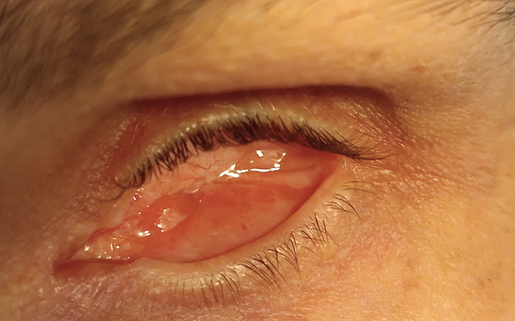 Zbiórka ekspertyz bud.remont,proteza oka - zdjęcie główne