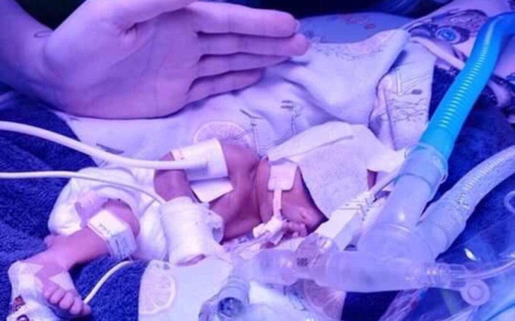 Zbiórka Maksym 25 tc 700 g - zdjęcie główne