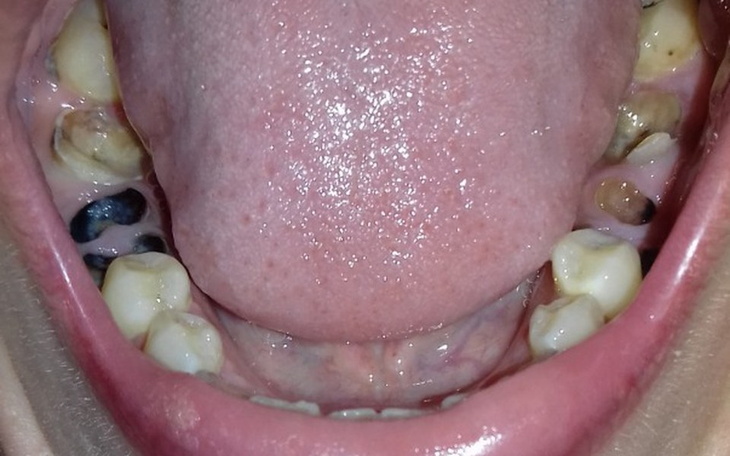 Zbiórka Leczenie i usuwanie zębów - zdjęcie główne