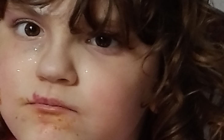 Zbiórka Leczenie Zuz - zdjęcie główne