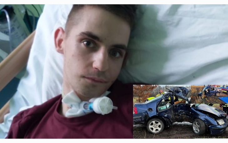 Młody mężczyzna w szpitalu, z widocznymi obrażeniami po wypadku samochodowym.