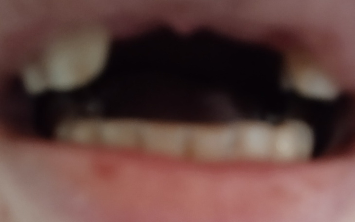 Zbiórka Pomóż mi odzyskać uśmiech - zdjęcie główne