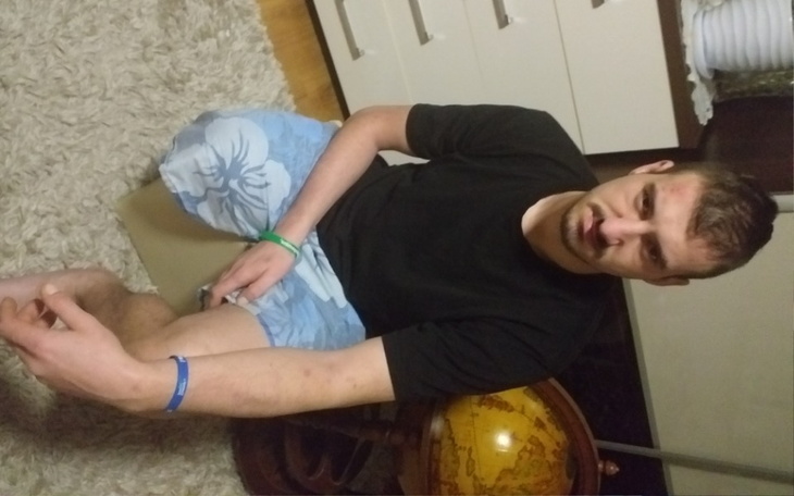 Zbiórka Na protezę nogi dla Mariusza - zdjęcie główne