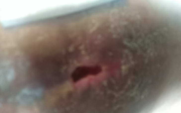 Zbiórka Proszę o pomoc pszed amputacja - zdjęcie główne