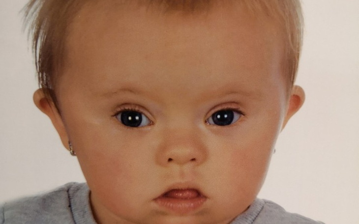 Zbiórka Turnusy i rehabilitacje - zdjęcie główne