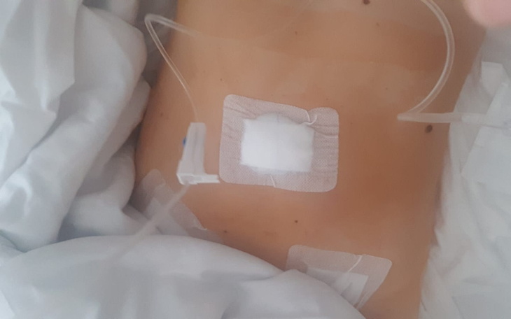 Zbiórka By pokonać Endometrioze - zdjęcie główne