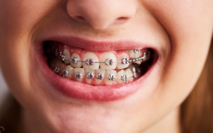 Zbiórka Studentka w potrzebie - zdjęcie główne