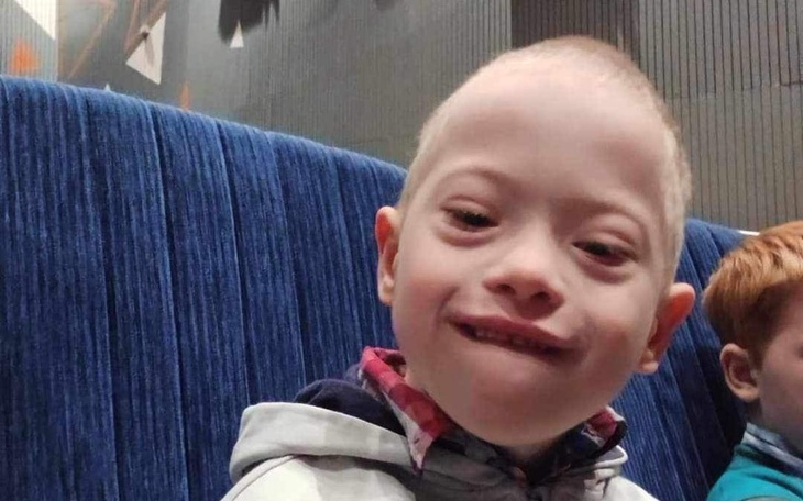 Chłopiec z zespołem Downa, uśmiechający się do kamery.