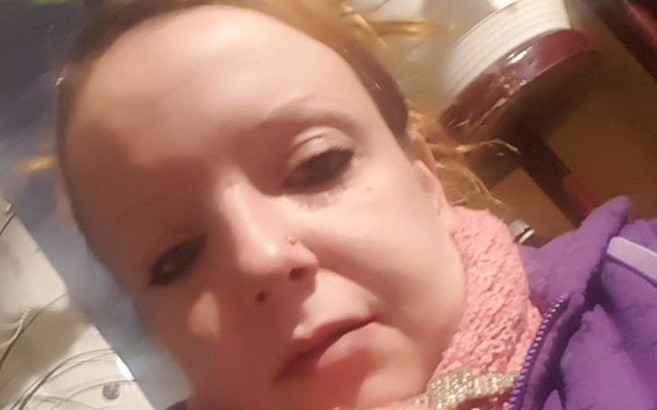 Zbiórka Operacja padaczki.. - zdjęcie główne