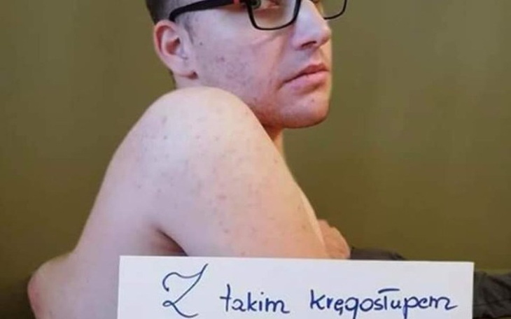 Zbiórka Potrzebuję operacji kręgosłupa - zdjęcie główne