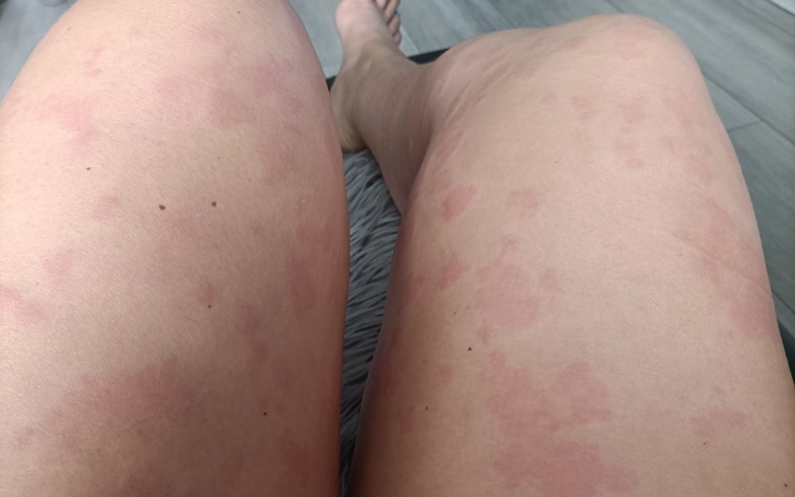 Zbiórka Pomóż zebrać kwotę na leczenie - zdjęcie główne