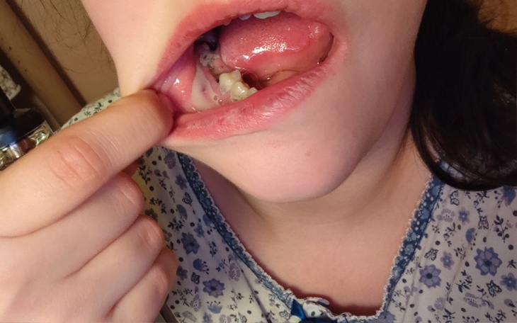 Zbiórka Pomoc w leczeniu stomatologiczny - zdjęcie główne