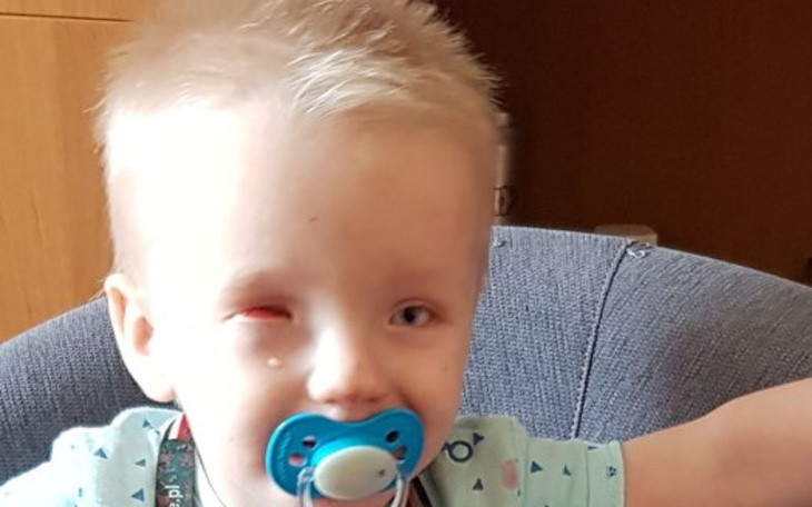 Zbiórka Zbieram na oczko - zdjęcie główne