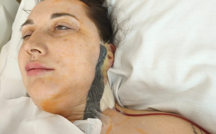 Kobieta w szpitalu, z widocznymi obrażeniami.