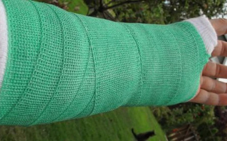 Zbiórka Rehabilitacja ręki po upadku - zdjęcie główne