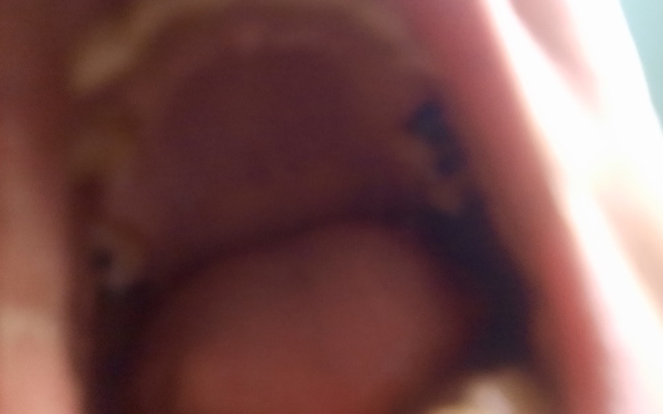 Zbliżenie na otwarte usta.