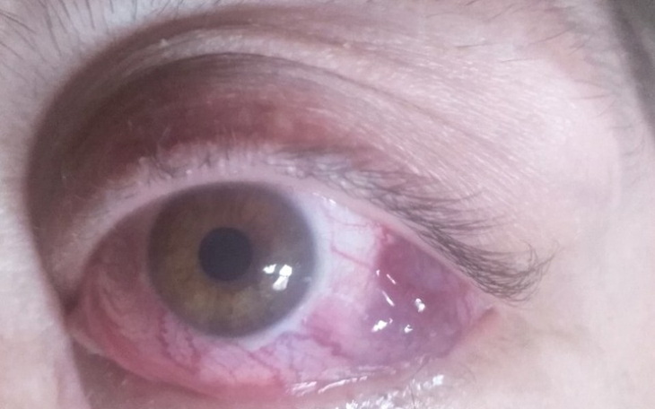 Zbiórka Guz środkowy czaszki i oczodołu. - zdjęcie główne