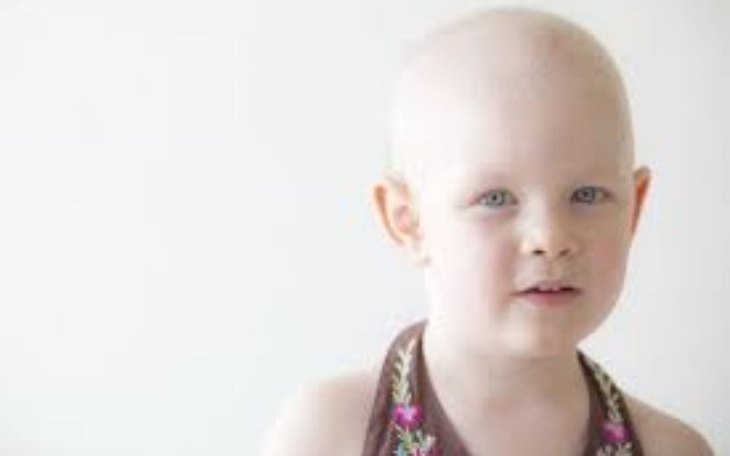 Mały chłopiec z jasnymi oczami i łysą głową.