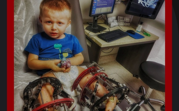 Zbiórka Zbieramy pieniądze na operacje B - zdjęcie główne