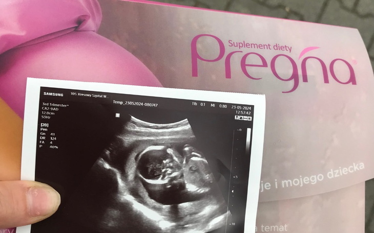 Zbiórka Na wyprawkę na maluszka - zdjęcie główne