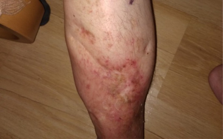 Zbiórka leczenie i rehabilitacja po  wyp - zdjęcie główne