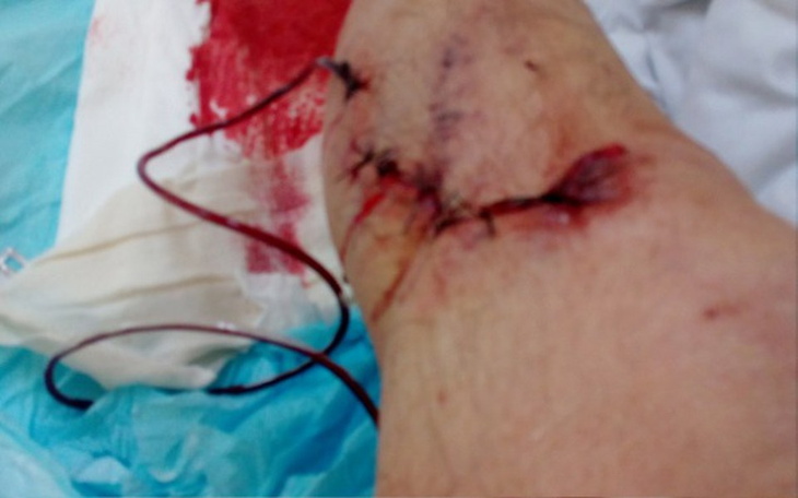 Zbiórka Zbiorka na leki - zdjęcie główne