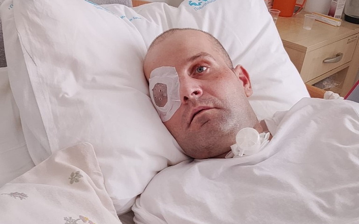 Mężczyzna w łóżku z opatruną twarzą, pobolałe zdjęcie po zabiegu