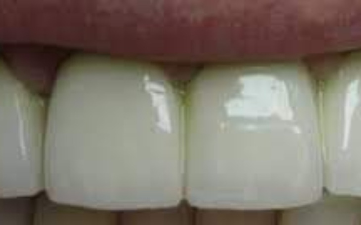 Zbiórka Na odbudowę uśmiechu - zdjęcie główne