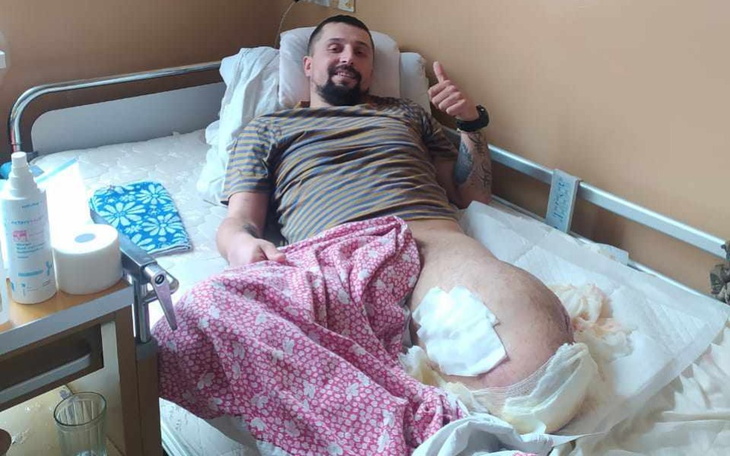 Zbiórka Na protezę nogi dla kolegi - zdjęcie główne